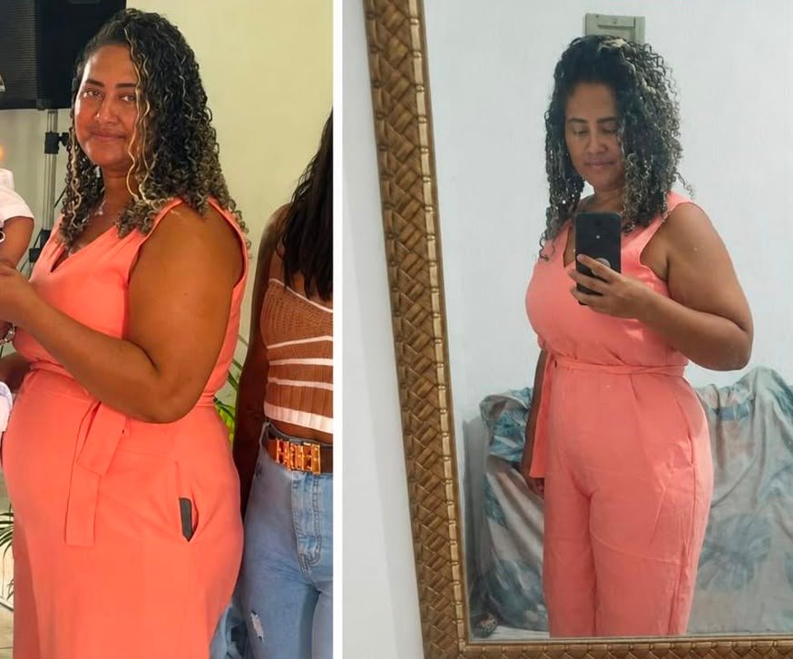 Francilene, antes e depois, perda de 20kg